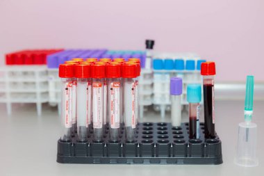 10 Kasım 2020 Chisinau Moldova Vakum kan örnekleme sistemi bir Vacuette konteynırında. Klinikteki analizler. İllüstrasyon Editörü