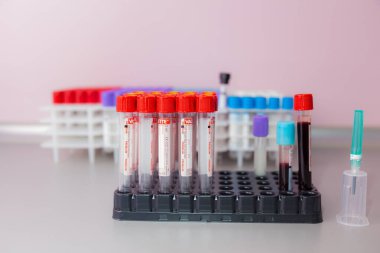 10 Kasım 2020 Chisinau Moldova Vakum kan örnekleme sistemi bir Vacuette konteynırında. Klinikteki analizler. İllüstrasyon Editörü