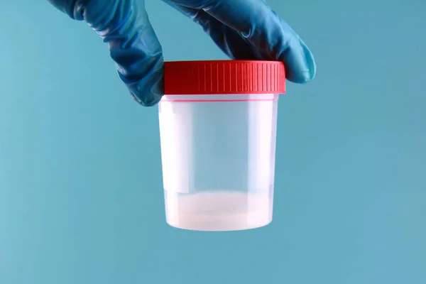 Tek kullanımlık mavi eldivenli bir doktorun elinde mavi tıbbi geçmişi olan bir sperm analiz kavanozu bulunur. Laboratuvar ve sperm analizi ve bağış konsepti.