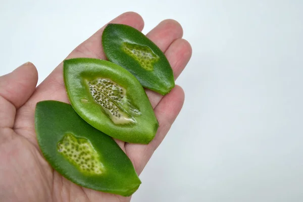 Hand Female Gardener Holds Sick Leaves Money Tree Affected Rot — Stock Photo, Image