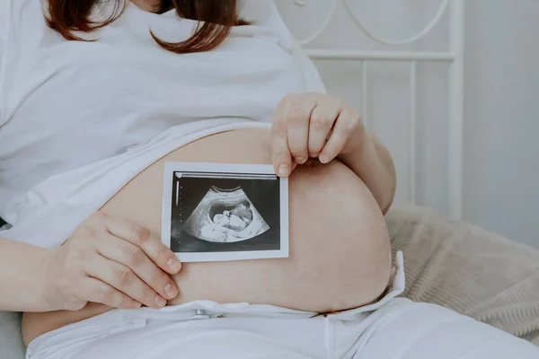 Kobieta Ciąży Trzyma Usg Podczas Siedzenia Łóżku Sypialni Widok Bliska — Zdjęcie stockowe