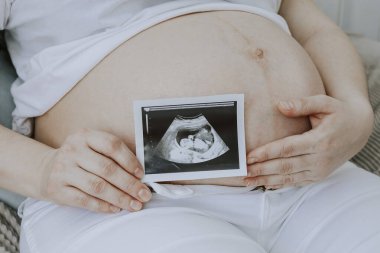 Yatakta otururken karnında ultrason görüntüsü taşıyan bir kadın..