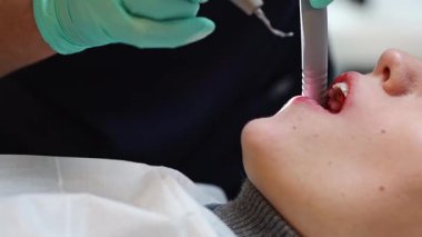 Bir genç beyaz dişçi, alt çenesindeki bir dişten tartar temizliyor. Hasta bir kıza özel aletlerle, çok yakından bakıyor. Sakız ve diş tedavisi kavramı, dişçi günü, diş tedavisi zamanı..