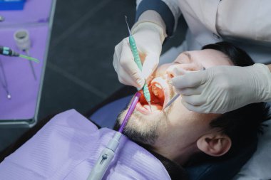 Doktorlar beyaz lateks eldivenler veriyorlar hastaların ağızlarını sonda, ağız aynası ve tükürük püskürtücüyle temizliyorlar. Yakın çekim, yukarıdan aşağıya manzara. Konsept: Sözlü tedavi, dişçiler günü.