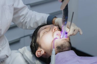 Tanımlanamayan bir dişçi ve asistanı, bir azı dişini mavi bir lambayla tedavi ediyor. Ofisteki beyaz bir adamı iyileştirmek için. Yakın çekim, yukarıdan aşağıya manzara. Kavram: diş sağlığı, teknoloji kullanımı, diş hekimleri günü.