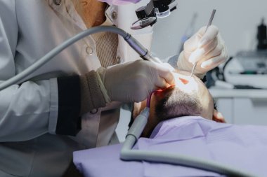 Bir dişçi diş matkabı ve diş kliniğinde ağız aynası kullanarak dişlerini temizlerken genç bir beyaz adam sandalyede uzanıyor. Yakın plan, yan görüş. Konsept: diş sağlığı, ağız hastalığı tedavisi, diş hekimleri günü.