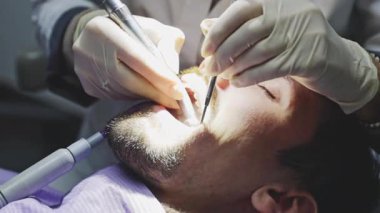 Tanınmayan bir diş hekimi diş matkabı, ağız aynası ve tükürük püskürtücü kullanan genç bir beyaz adama diş ameliyatı yapar. Yan görüş, aşırı yakın çekim, yavaş çekim. Konsept: Oral tedavi, dişçi çalışma günü, teknoloji kullanımı.