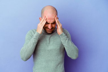 Kafkasyalı kel adam mor arka planda izole edilmiş tapınaklara dokunuyor ve baş ağrısı çekiyor..