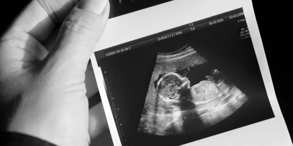 Ultraljud Gravid Kvinna Som Väntar Sitt Barn Med Mycket Kärlek — Stockfoto