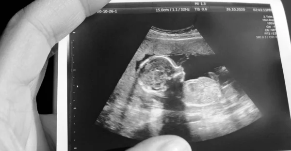 Ultraljud Gravid Kvinna Som Väntar Sitt Barn Med Mycket Kärlek — Stockfoto