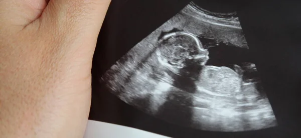 Ultraljud Gravid Kvinna Som Väntar Sitt Barn Med Mycket Kärlek — Stockfoto