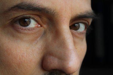 Yakışıklı Bir Adamın Gözleri ve Bakışı - Ptosis