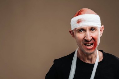 Kafası bandajlı ve kolunda alçı olan hırpalanmış bir adam gri bir arka planda duruyor..