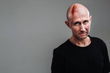 Uyuşturucu bağımlısı gibi görünen siyah tişörtlü hırpalanmış bir adam ve gri bir arka planda duran bir ayyaş..