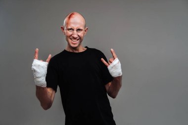 Gri bir arka planda siyah tişörtlü hırpalanmış bir adam duruyor..