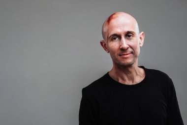 Uyuşturucu bağımlısı gibi görünen siyah tişörtlü hırpalanmış bir adam ve gri bir arka planda duran bir ayyaş..