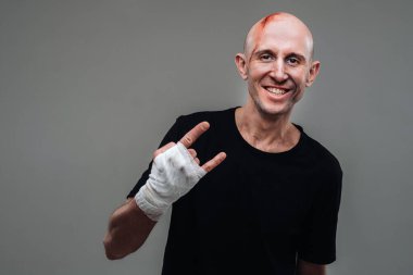 Gri bir arka planda siyah tişörtlü hırpalanmış bir adam duruyor.