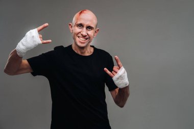 Gri bir arka planda siyah tişörtlü hırpalanmış bir adam duruyor..