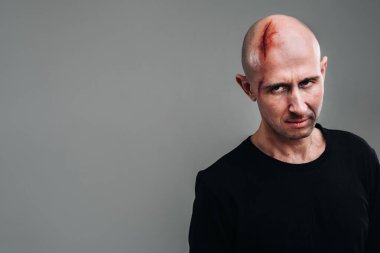 Uyuşturucu bağımlısı gibi görünen siyah tişörtlü hırpalanmış bir adam ve gri bir arka planda duran bir ayyaş..