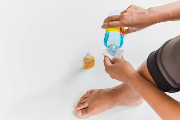 Woman Pouring Alcohol Cotton Cleaning Wound Her Feet — Stock Photo, Image