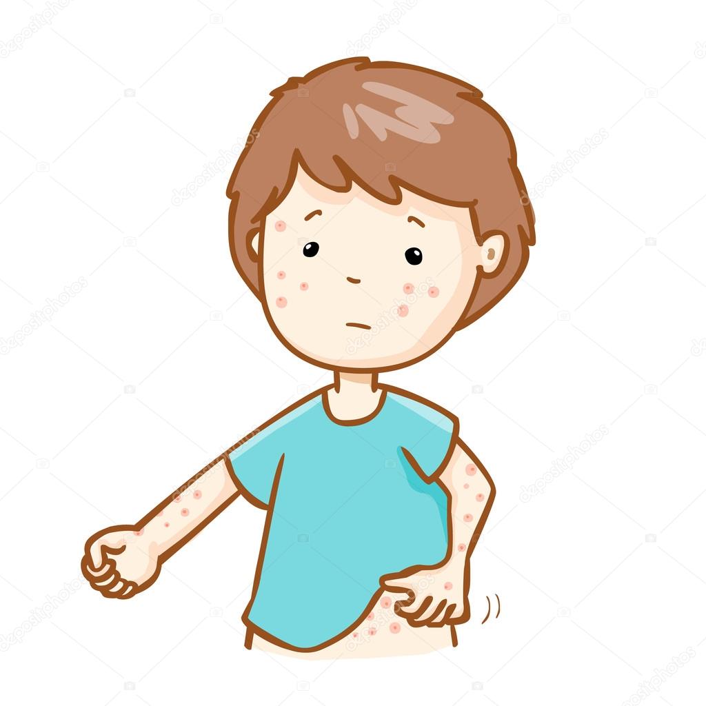 Man scratching itching rash on his body vector Stock Vector Image by  ©Onontour #88798844