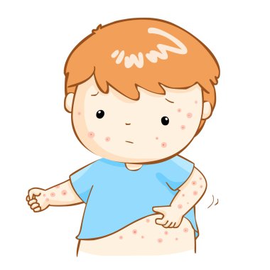boy scratching itching rash on his body vector clipart
