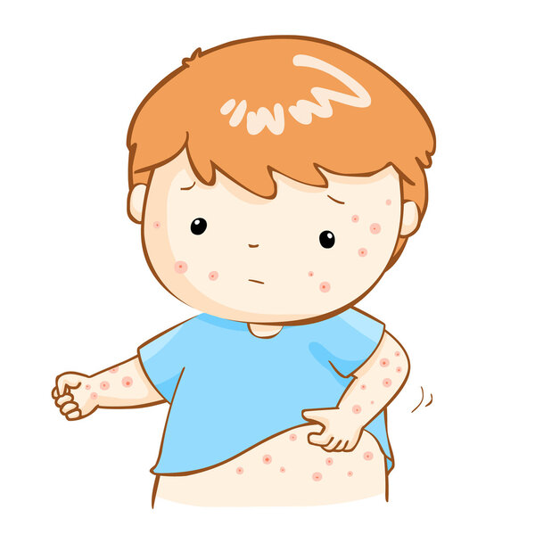boy scratching itching rash on his body vector