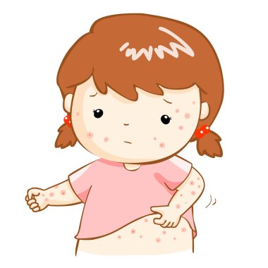 girl scratching itching rash on his body vector clipart