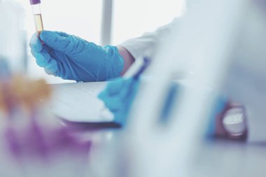 Kadın araştırmacı, beyaz arka planda izole edilmiş ilaç şişeleri ve mataralarla çevrili.