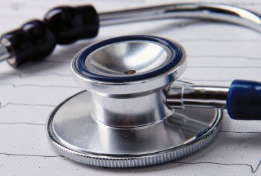 bir kardiyogram üzerinde mavi bir stetoskop