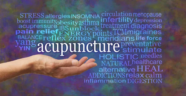 Cuvinte Asociate Beneficiile Utilizările Acupuncturii Mână Palmier Deschisă Feminină Cuvântul — Fotografie, imagine de stoc