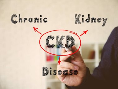  CKD Kronik Böbrek Hastalığı. Takım elbiseli genç işçiler arka planda yazı yazıyor.