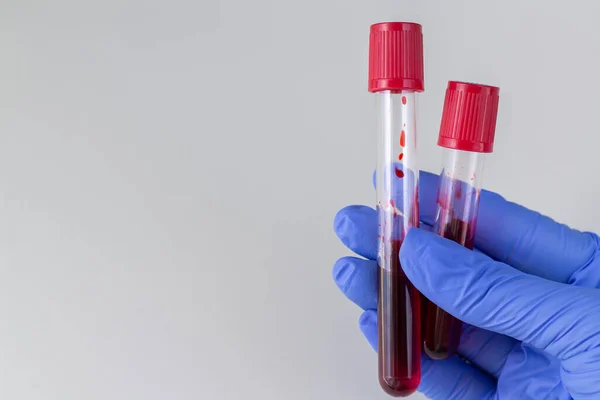 Doktor, kırmızı kanla test tüplerini hazır tutuyor. Metnin için boşluk