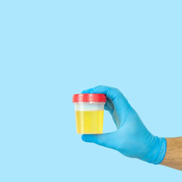 Docteur Tenant Récipient Échantillon Urine Pour Analyse Urine Médicale Concept — Photo