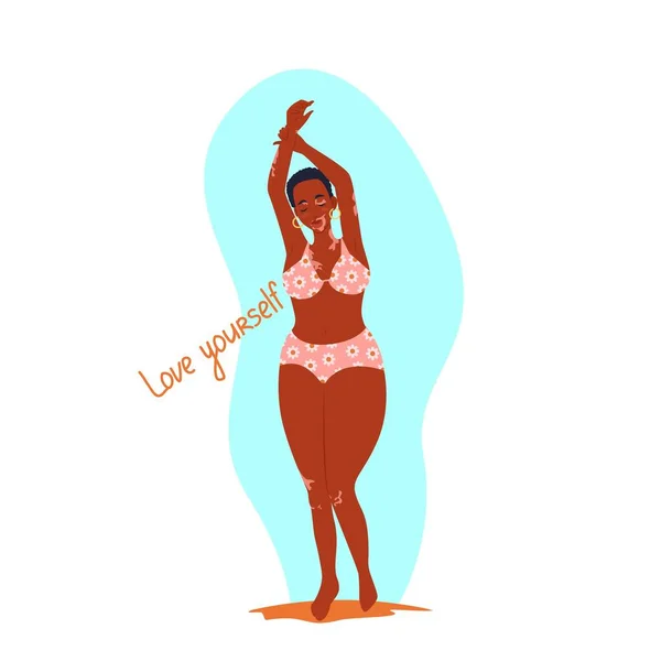 Mujer afroamericana con vitiligo en traje de baño con los brazos levantados, cuerpo positivo, ilustración vectorial en estilo plano. Caricatura — Archivo Imágenes Vectoriales