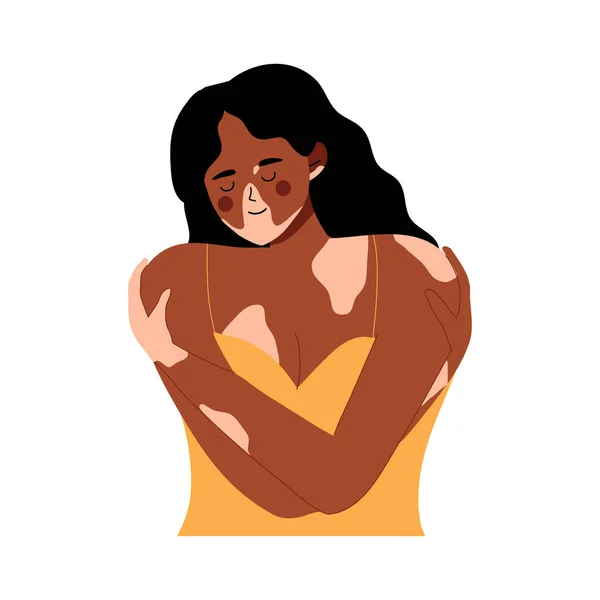 女人抱着自己的皮肤问题 白癜风 身体积极的自爱 变性疾病 世界白垩风日 支持白癜风患者 并提高对慢性皮肤病的认识 — 图库矢量图片