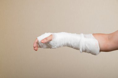 Bandaj ile kırık el