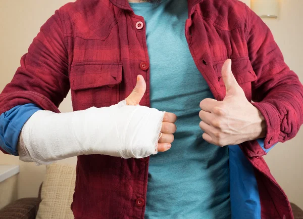 Сломанная рука с бинтом — стоковое фото
