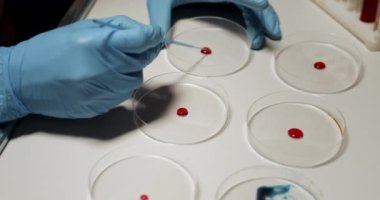 Doktor, Petri Dish 'i kullanarak kan tahlilleriyle uğraşıyor. Boold Testleri, Virüs Testi, Laboratuvar Konsepti. Eller Yakın