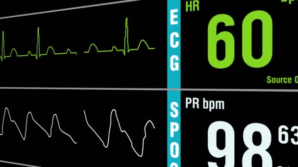 Patient monitor displays medical exam vital signs — Stock Video
