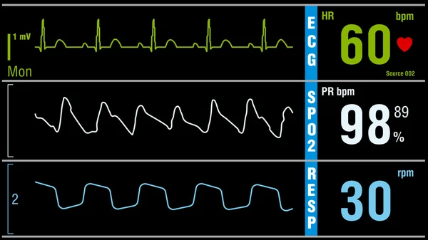 Monitor pasien menampilkan tanda-tanda vital pemeriksaan medis - Stok Vektor