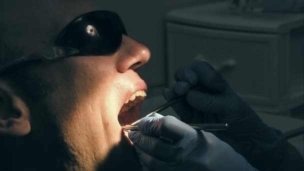 Man gets dentist medical mouth teeth examination — Stock Video