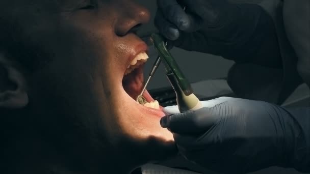 Homem recebe exame médico odontológico e tratamento — Vídeo de Stock
