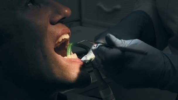 L'uomo ottiene visita medica dentale e trattamento — Video Stock