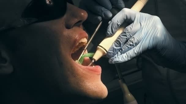 L'uomo di mezza età ottiene denti medici rimuovere il calcolo — Video Stock