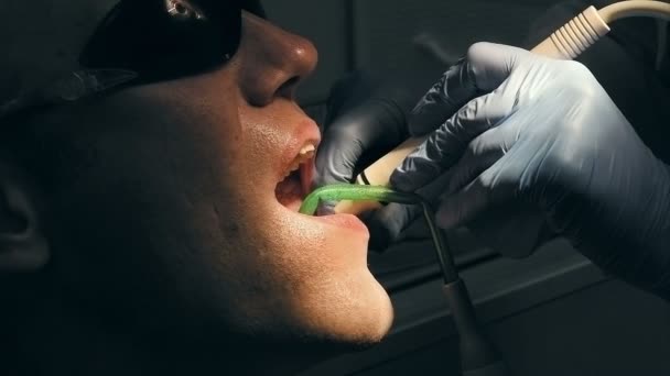 Чоловік середнього віку отримує медичні зуби видалення числення — стокове відео