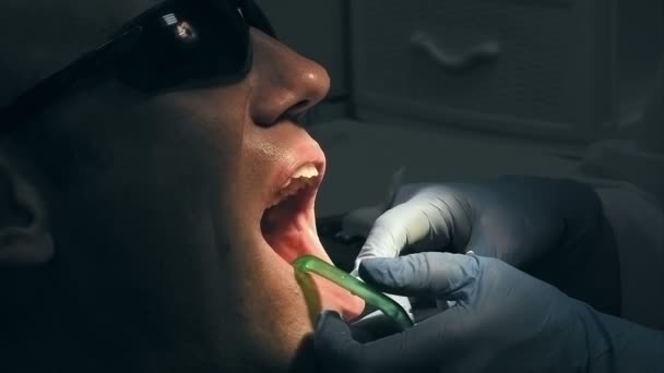 Człowiek dostaje stomatologiczne badania lekarskie i leczenie — Wideo stockowe