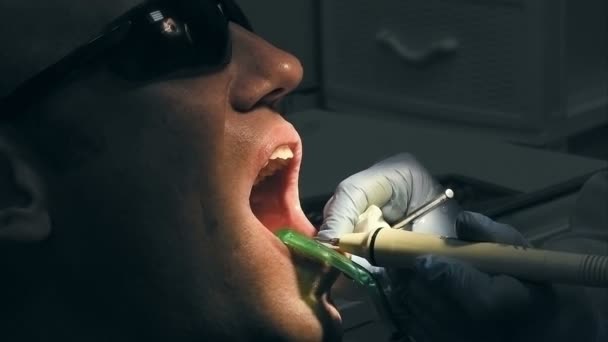 Közepes korú ember kap orvosi fogak fogkő eltávolítása — Stock videók