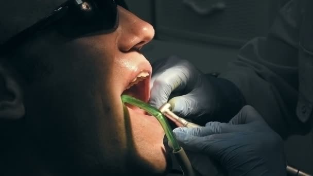 Mitten av ålder får man medicinsk tänder att ta bort tandsten — Stockvideo