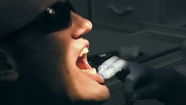 Человек получает стоматологическое обследование и лечение — стоковое видео